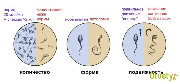 Как правильно сдавать спермограмму